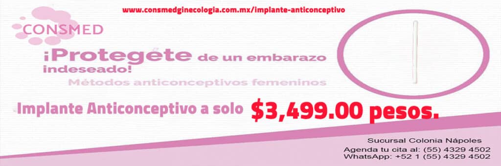 Implante Anticonceptivo Precio